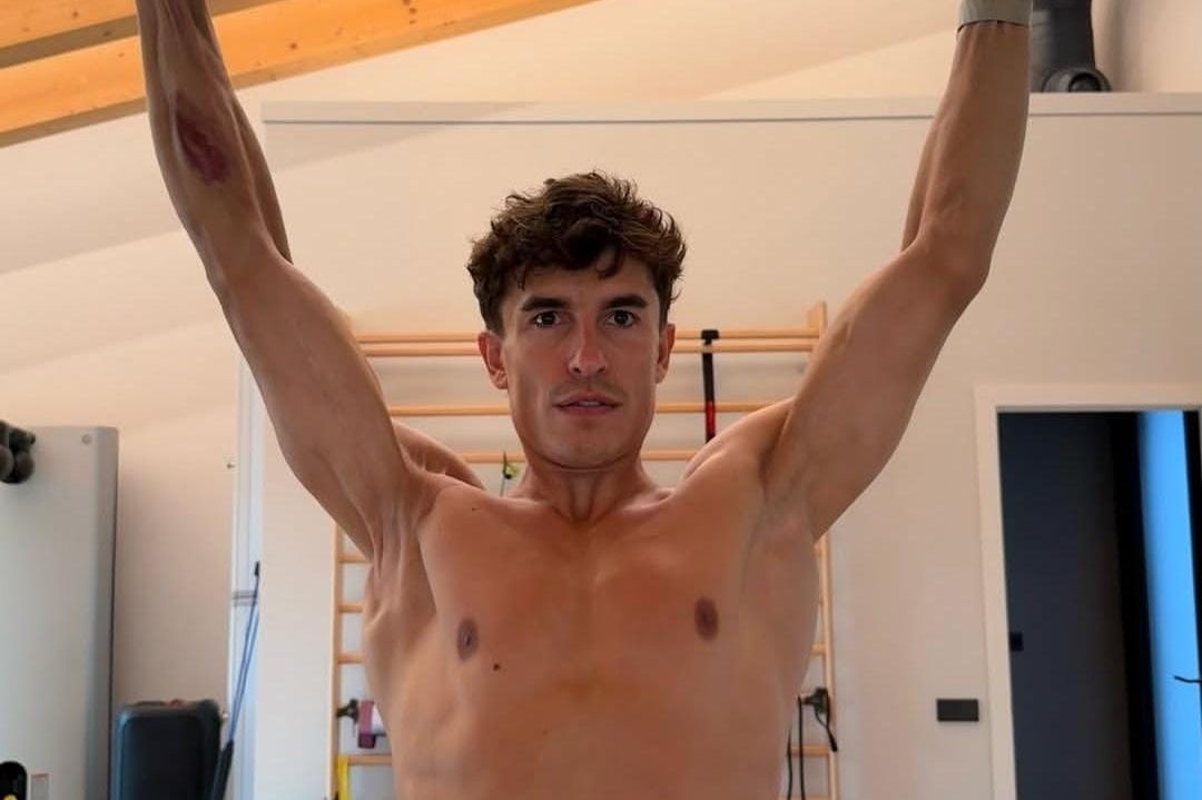Marc Marquez Shockingly Shares Graphic MotoGP Photo of His Injured Right Arm